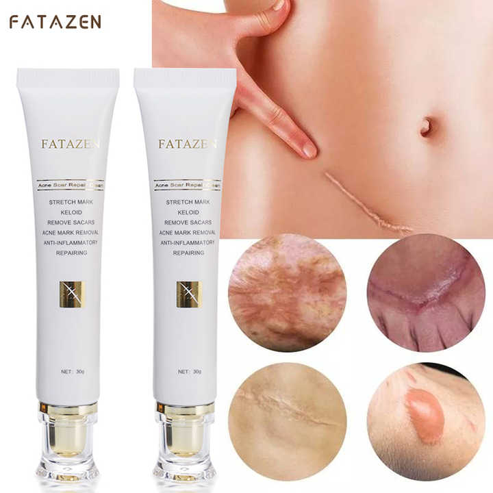 Scar Removal Cream