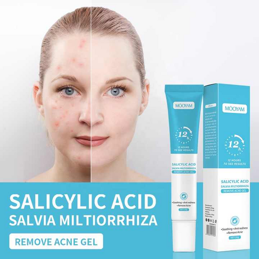 Acne Gel Remover