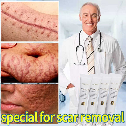 Scar Removal Cream