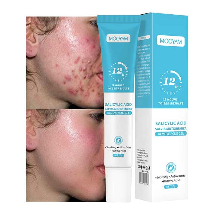 Acne Gel Remover GA